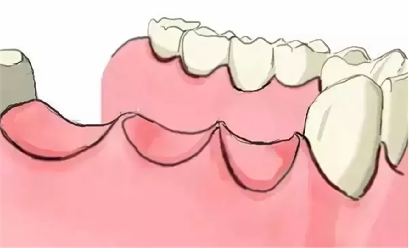 R-C (2)