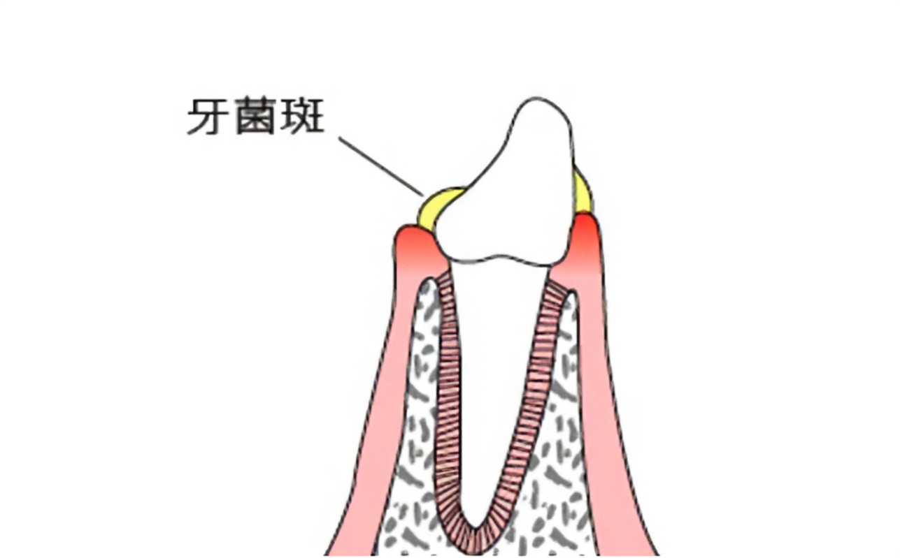 R-C (3)