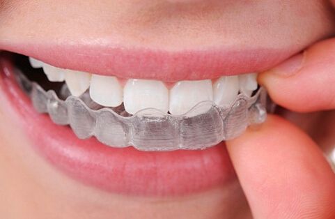 什么是牙齿矫正？