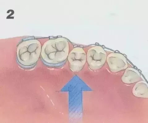 R-C (1)